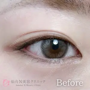 仙台N美容クリニック 小阪 捺稀医師の症例