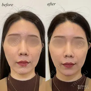 DMTC美容皮膚科 日本橋院の症例