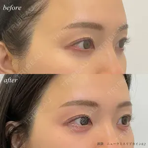 DMTC美容皮膚科 日本橋院 松井泉医師の症例