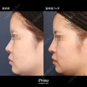 プリモ麻布十番クリニック 大場教弘医師の症例
