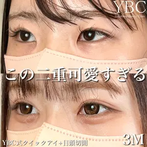 YBC横浜美容外科 大宮院 磯村 亮輔医師の症例