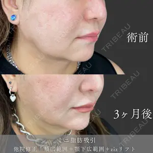 ziz CLINIC 村岡 史子医師の症例