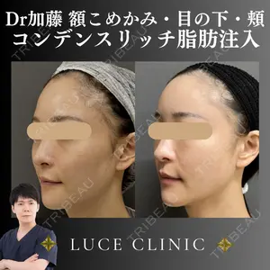 ルーチェクリニック 銀座院 加藤晴之輔医師の症例