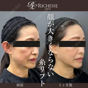 銀座リシェスクリニックの症例