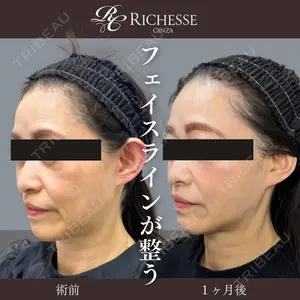 銀座リシェスクリニックの症例