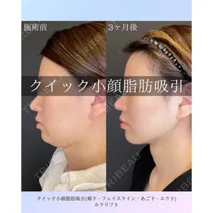 ルラ美容クリニック 札幌院 佐藤 雄紀医師の症例