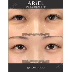 アリエル美容クリニック 大宮院の症例