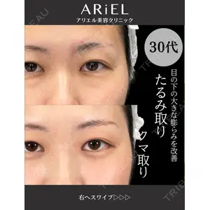 アリエル美容クリニック 大宮院の症例