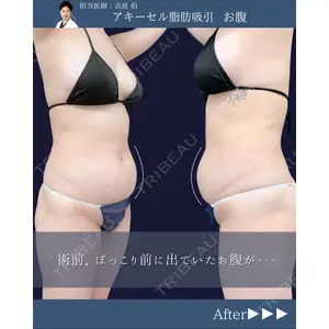 東京シンデレラ美容外科 新宿院 吉原 伯医師の症例