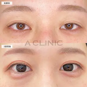 A CLINIC（エークリニック） 池袋院 三橋 克之医師の症例