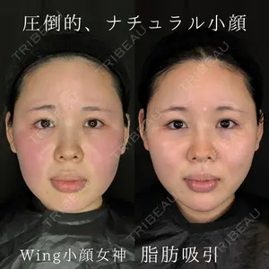 Wing clinic 豊中駅前院 速水 翼医師の症例