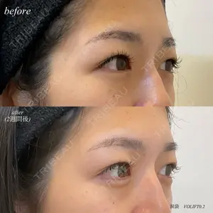 DMTC美容皮膚科 日本橋院 松井泉医師の症例