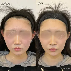 DMTC美容皮膚科 日本橋院 松井泉医師の症例