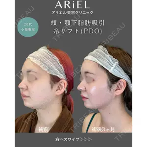 アリエル美容クリニック 郡山院 安齋 誠基医師の症例