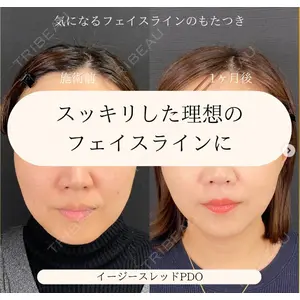 自由が丘ウェルエイジングビューティークリニックの症例