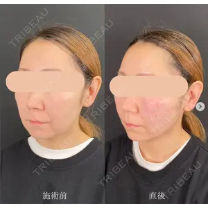 自由が丘ウェルエイジングビューティークリニックの症例