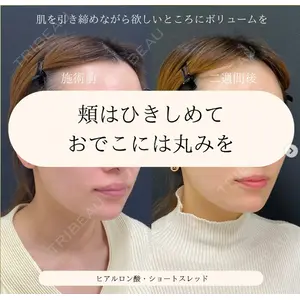 自由が丘ウェルエイジングビューティークリニックの症例