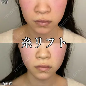 形成外科と美容外科のクリニック池袋 春日 航医師の症例