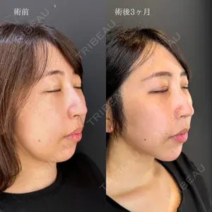 HAAB×DREAM BEAUTY CLINIC 東京本院 吉岡 修一医師の症例