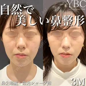 YBC横浜美容外科 大宮院 磯村 亮輔医師の症例