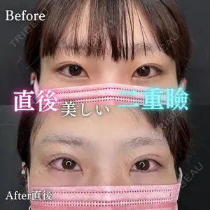 ルラ美容クリニック 渋谷本院 住友 沙織医師の症例