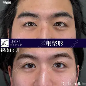 ネビュラクリニック 京都院 岸 大輔医師の症例