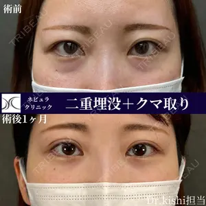 ネビュラクリニック 京都院 岸 大輔医師の症例