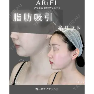 アリエル美容クリニック 郡山院 安齋 誠基医師の症例
