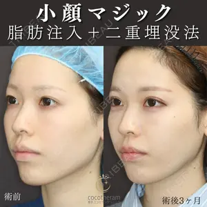 東京ココセランクリニック 篠﨑 智公医師の症例