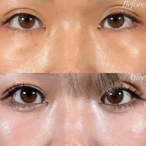 R Beauty CLINIC 名古屋院 木村 尚大医師の症例