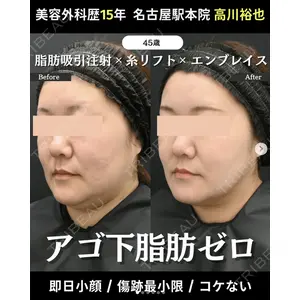 湘南美容クリニック 名古屋駅本院 高川 裕也医師の症例