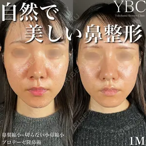 YBC横浜美容外科 大宮院 磯村 亮輔医師の症例