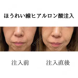 おおたかの森ビューティークリニックの症例