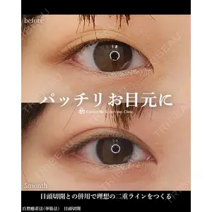 シンデレラ＆ダヴィンチクリニック 宮田 洋佑医師の症例