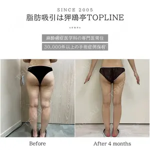 狎鴎亭トップライン医院の症例