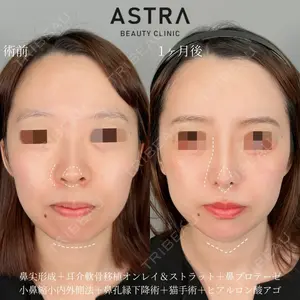 ASTRA BEAUTY CLINIC 塩満 惠子医師の症例