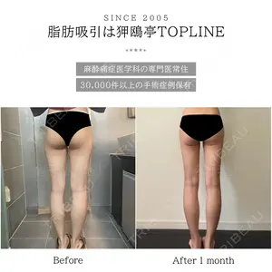 狎鴎亭トップライン医院の症例