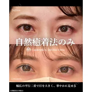 シンデレラ＆ダヴィンチクリニック 宮田 洋佑医師の症例