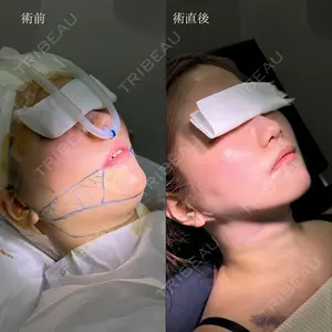 HAAB×DREAM BEAUTY CLINIC 東京本院 吉岡 修一医師の症例