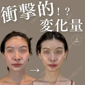 藤・ナチュレ美容クリニック 銀座院 鍵野 攻允医師の症例
