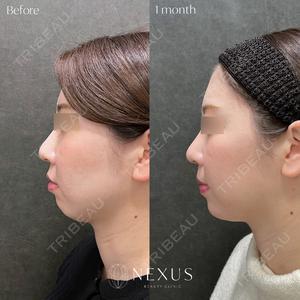 NEXUS CLINICの症例