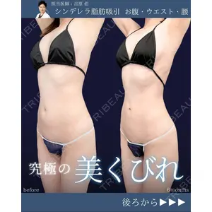東京シンデレラ美容外科 新宿院 吉原 伯医師の症例