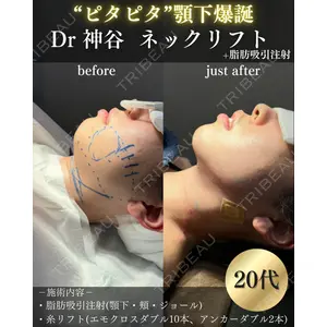 EMMO FACE CLINIC 大阪梅田院 神谷 一成医師の症例