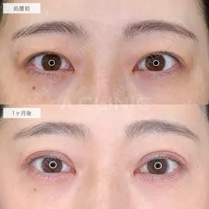 A CLINIC（エークリニック） 仙台院 伊藤 瑠桂医師の症例