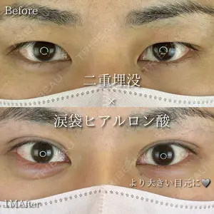 ルラ美容クリニック 広島院 松尾 林太郎医師の症例