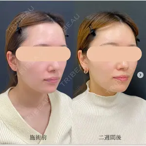 自由が丘ウェルエイジングビューティークリニックの症例