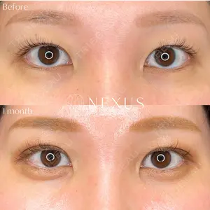 NEXUS CLINIC 横田 智子医師の症例