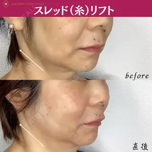 ギャラリークリニック 銀座の症例