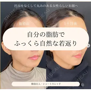 自由が丘ウェルエイジングビューティークリニックの症例