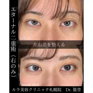 ルラ美容クリニック 札幌院 能登 貴弘医師の症例